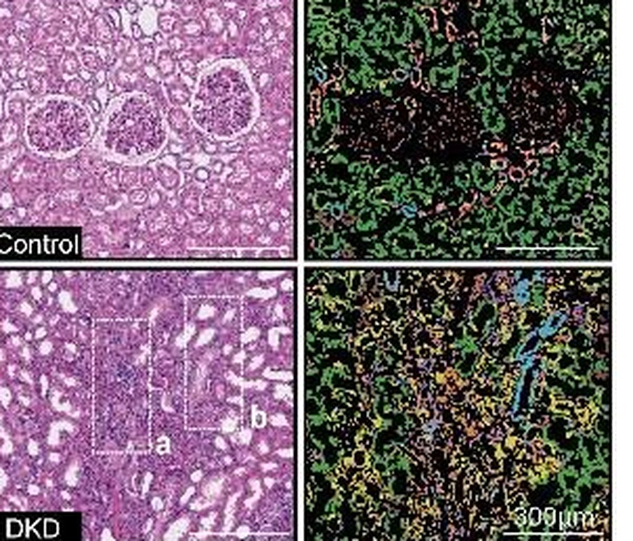 Control and diabetic kidney disease: histology beside the spatial molecular map of the same sections